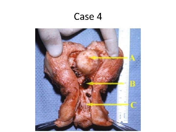Case 4 