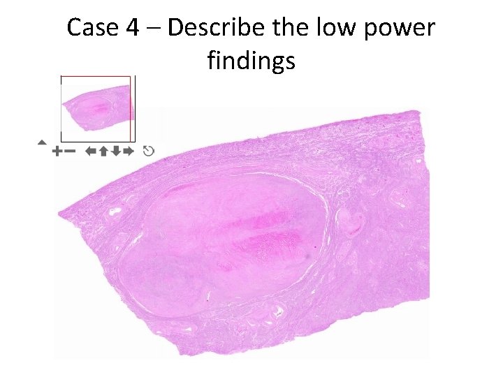Case 4 – Describe the low power findings 