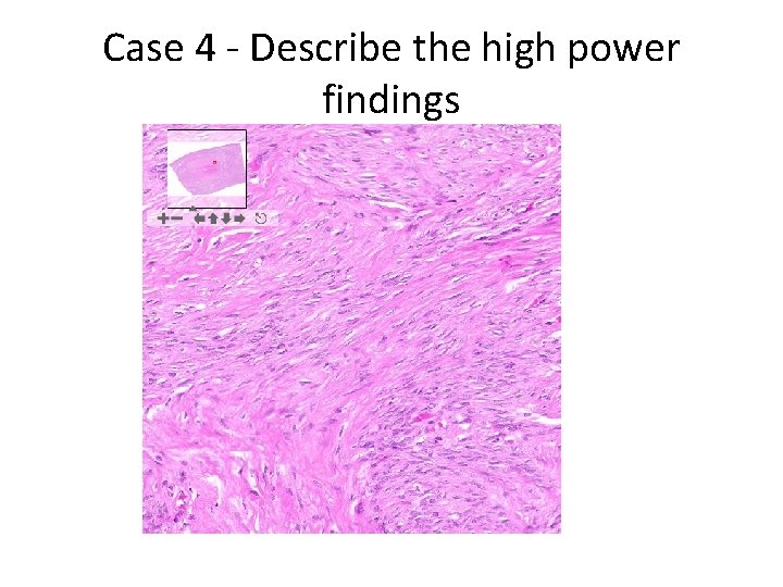 Case 4 - Describe the high power findings 