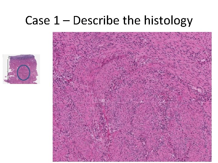 Case 1 – Describe the histology 