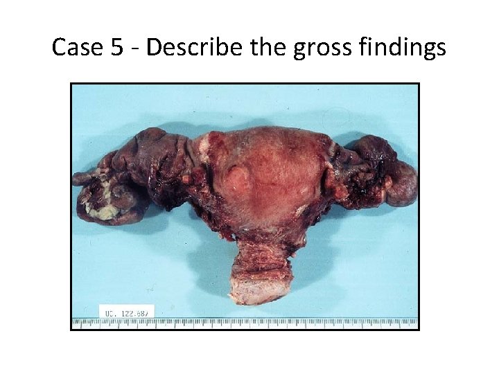 Case 5 - Describe the gross findings 