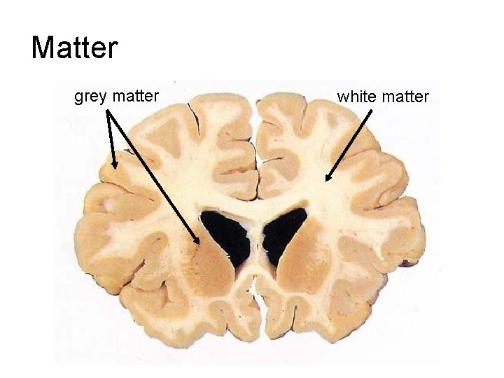 Matter grey matter white matter Matter grey matter white matter