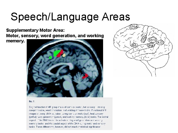 Speech/Language Areas Supplementary Motor Area: Motor, sensory, word generation, and working memory. Speech/Language Areas Supplementary Motor Area: Motor, sensory, word generation, and working memory.