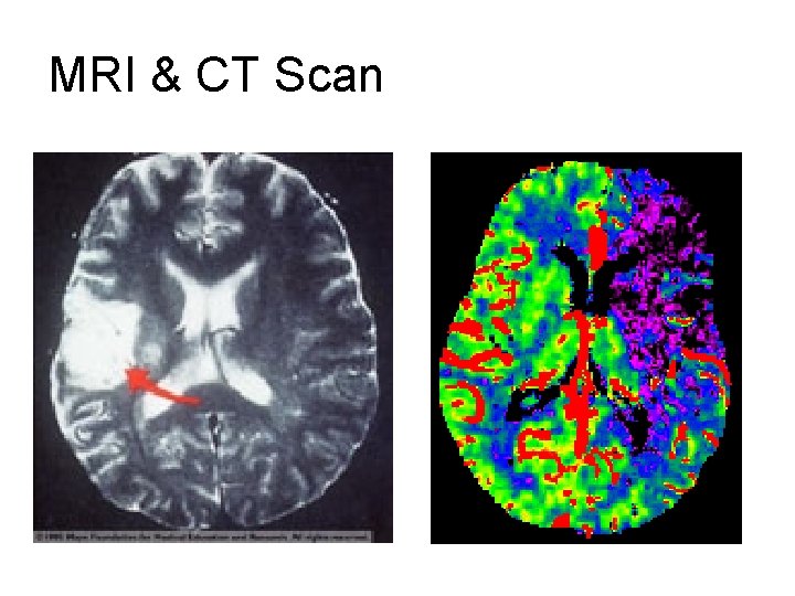 MRI & CT Scan MRI & CT Scan