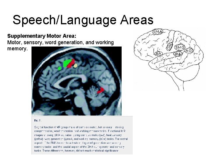 Speech/Language Areas Supplementary Motor Area: Motor, sensory, word generation, and working memory. Speech/Language Areas Supplementary Motor Area: Motor, sensory, word generation, and working memory.