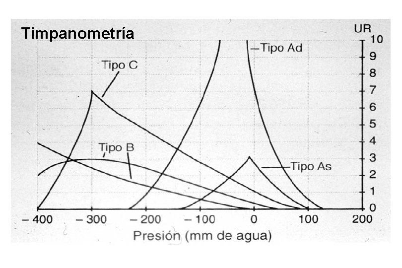 Timpanometría 