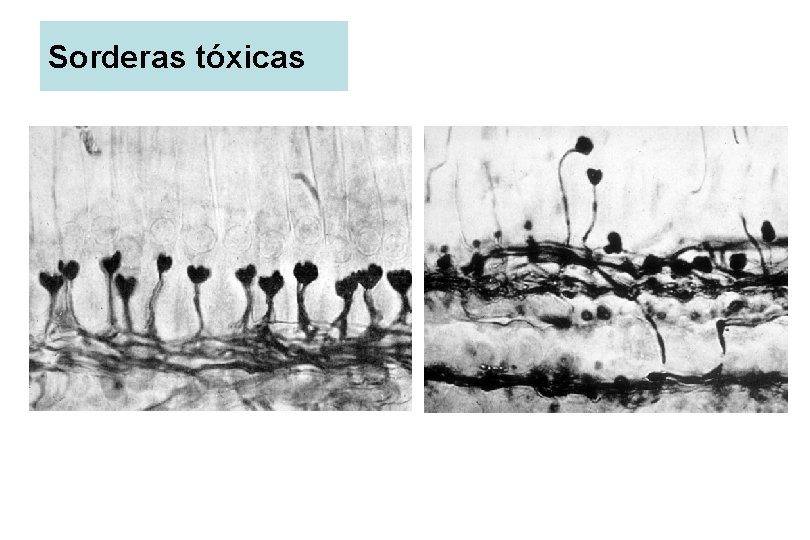 Sorderas tóxicas 