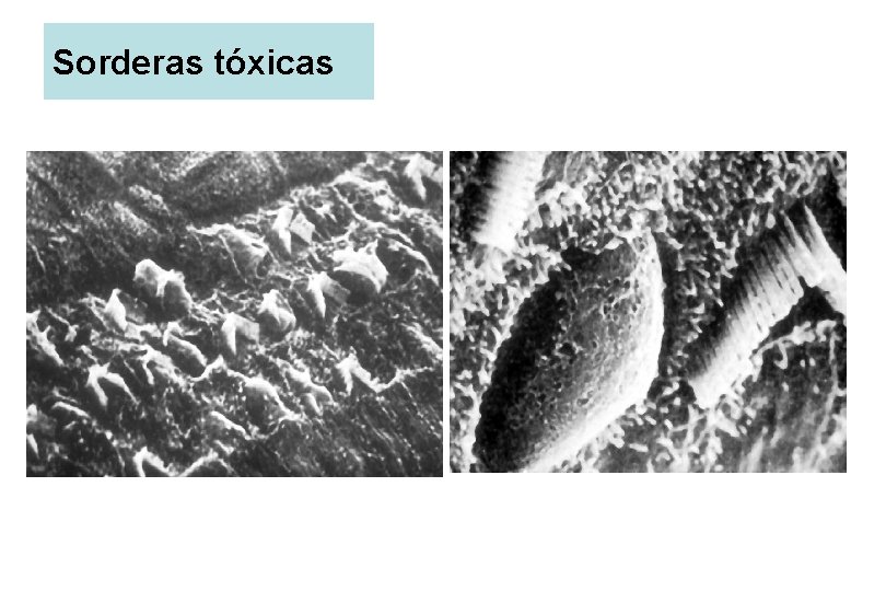 Sorderas tóxicas 