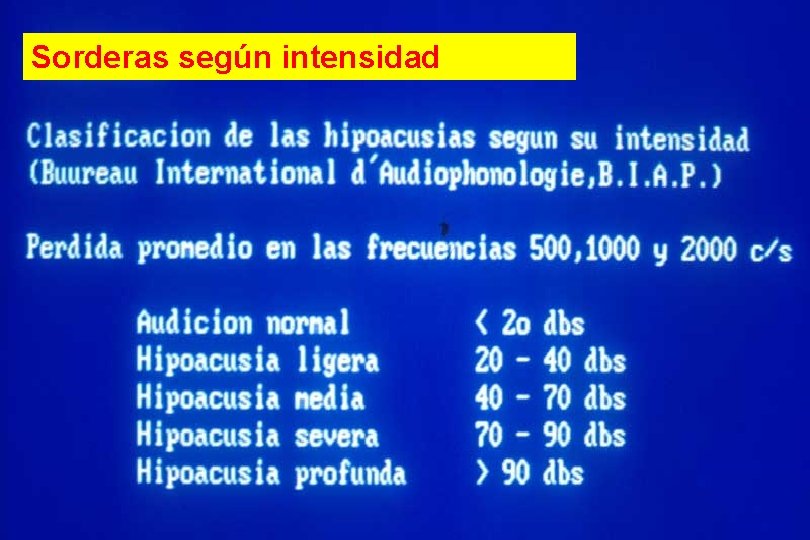 Alteraciones del lenguaje Sorderas según intensidad 