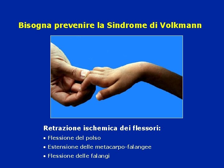 Bisogna prevenire la Sindrome di Volkmann Retrazione ischemica dei flessori: • Flessione del polso