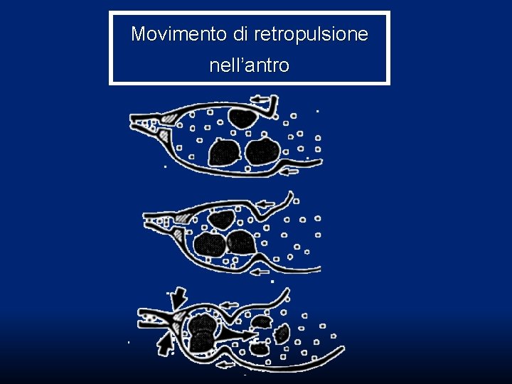 Movimento di retropulsione nell’antro Movimento di retropulsione nell’antro