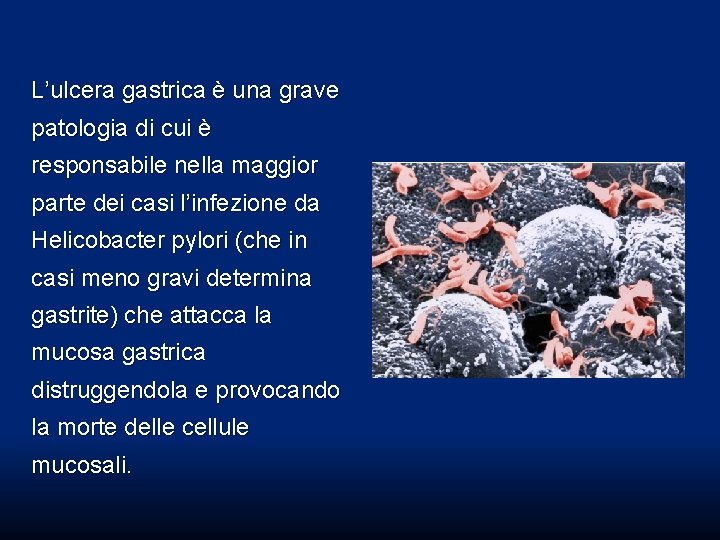 L’ulcera gastrica è una grave patologia di cui è responsabile nella maggior parte dei L’ulcera gastrica è una grave patologia di cui è responsabile nella maggior parte dei