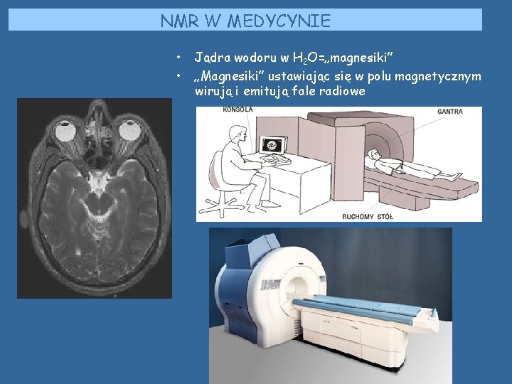 NMR W MEDYCYNIE • • Jądra wodoru w H 2 O=„magnesiki” „Magnesiki” ustawiając się NMR W MEDYCYNIE • • Jądra wodoru w H 2 O=„magnesiki” „Magnesiki” ustawiając się
