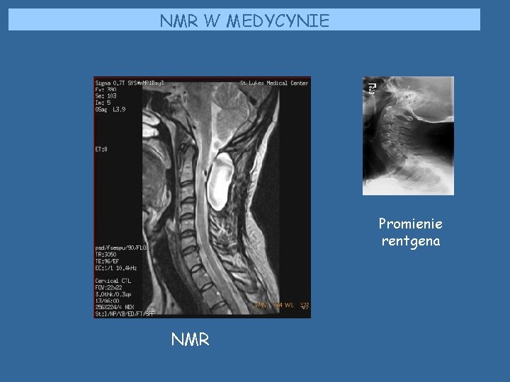NMR W MEDYCYNIE Promienie rentgena NMR NMR W MEDYCYNIE Promienie rentgena NMR