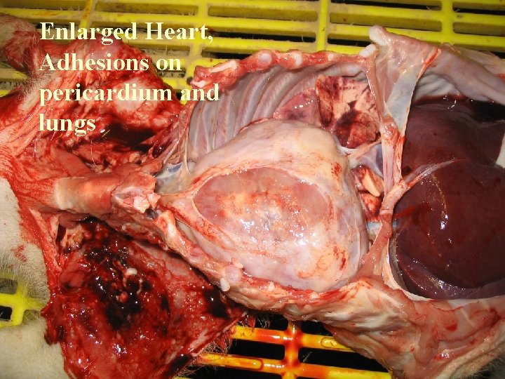 Enlarged Heart, Adhesions on pericardium and lungs 