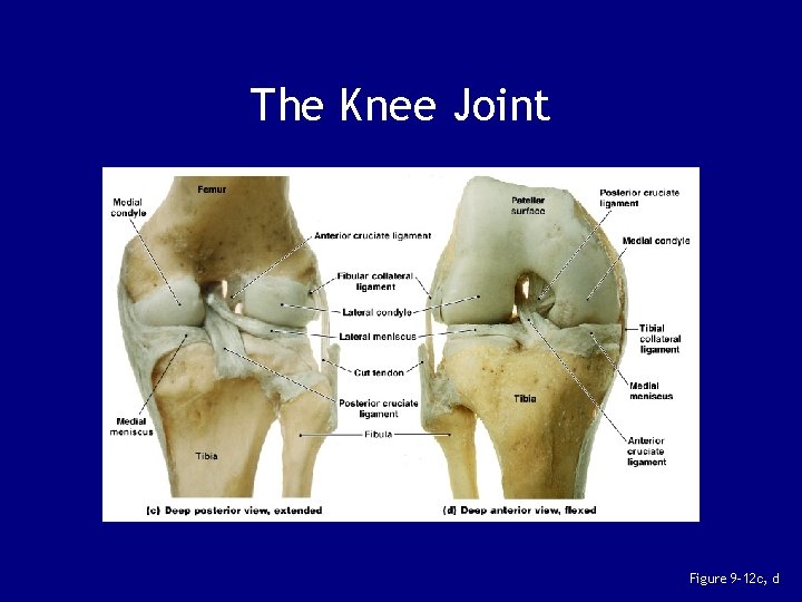 The Knee Joint Figure 9– 12 c, d 