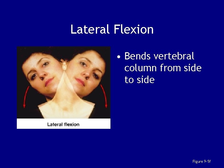Lateral Flexion • Bends vertebral column from side to side Figure 9– 5 f