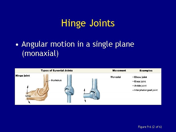 Hinge Joints • Angular motion in a single plane (monaxial) Figure 9– 6 (2