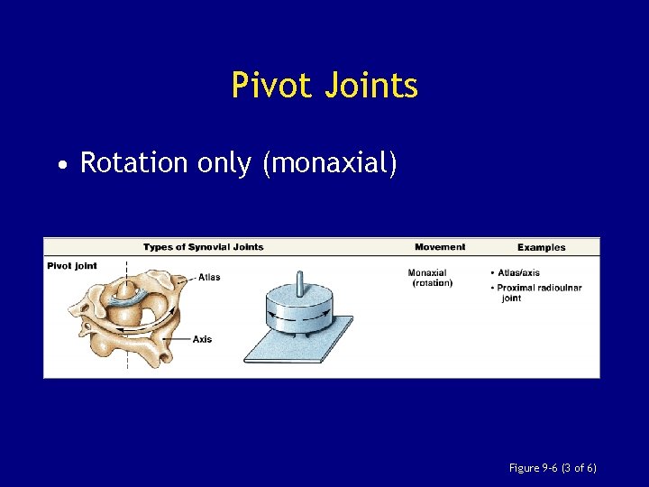 Pivot Joints • Rotation only (monaxial) Figure 9– 6 (3 of 6) 