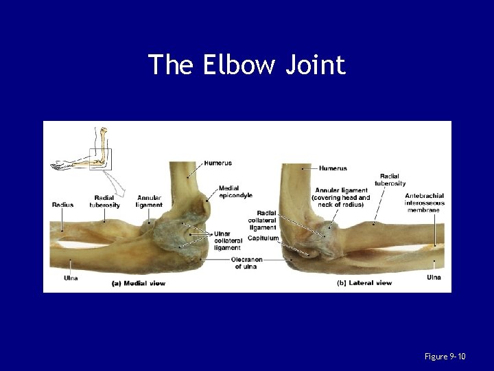 The Elbow Joint Figure 9– 10 