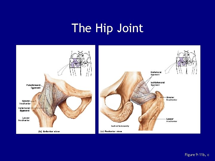 The Hip Joint Figure 9– 11 b, c 