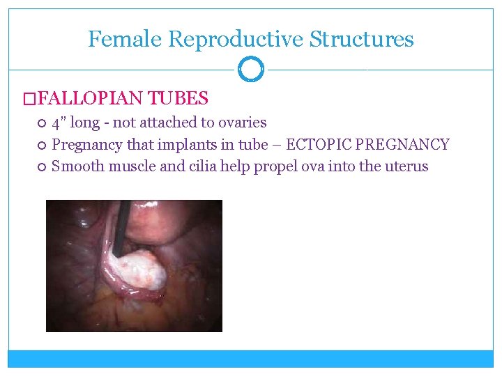 Female Reproductive Structures �FALLOPIAN TUBES 4” long - not attached to ovaries Pregnancy that