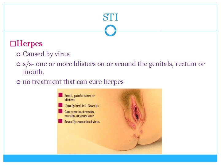 STI �Herpes Caused by virus s/s- one or more blisters on or around the