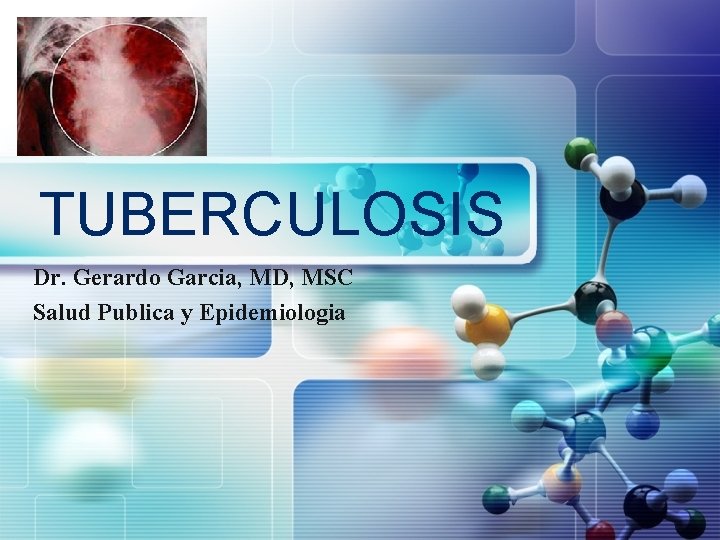 LOGO TUBERCULOSIS Dr. Gerardo Garcia, MD, MSC Salud Publica y Epidemiologia 