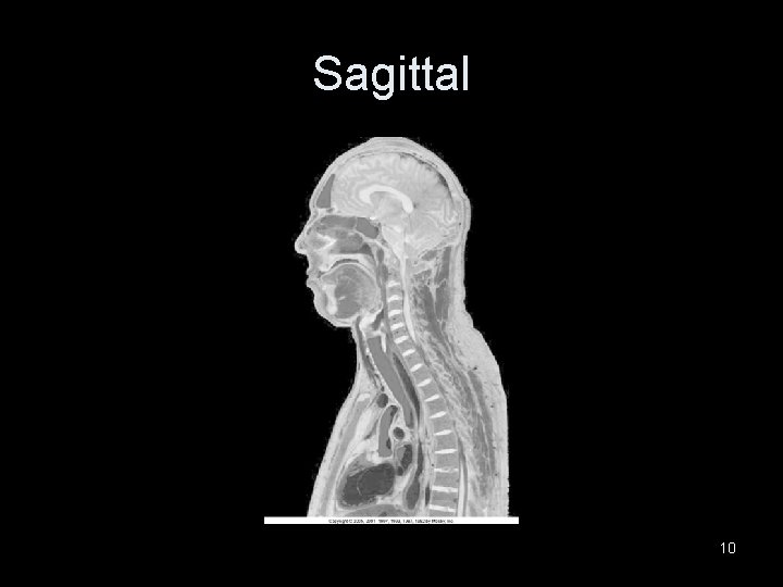 Sagittal 10 