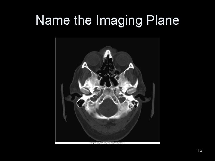 Name the Imaging Plane 15 