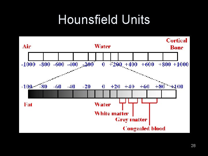 Hounsfield Units 28 