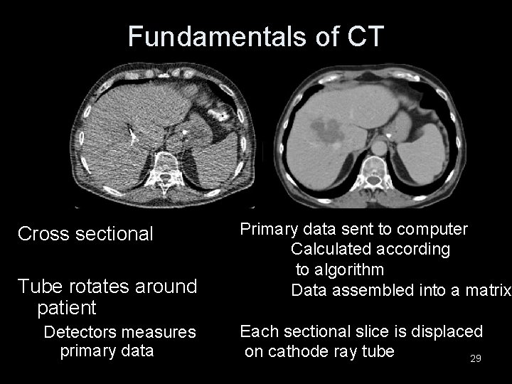 Fundamentals of CT Cross sectional Tube rotates around patient Detectors measures primary data Primary