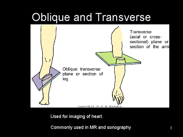 Oblique and Transverse Used for imaging of heart. Commonly used in MR and sonography