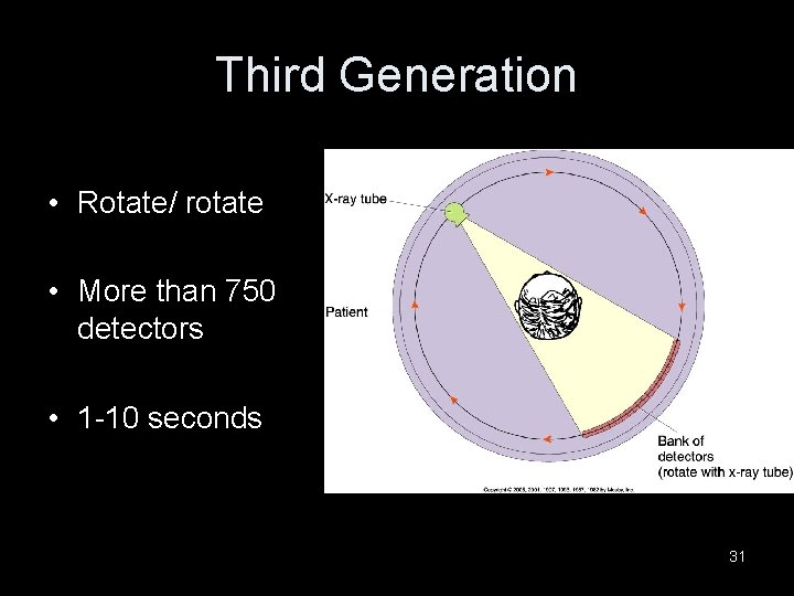 Third Generation • Rotate/ rotate • More than 750 detectors • 1 -10 seconds