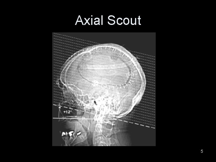 Axial Scout 5 