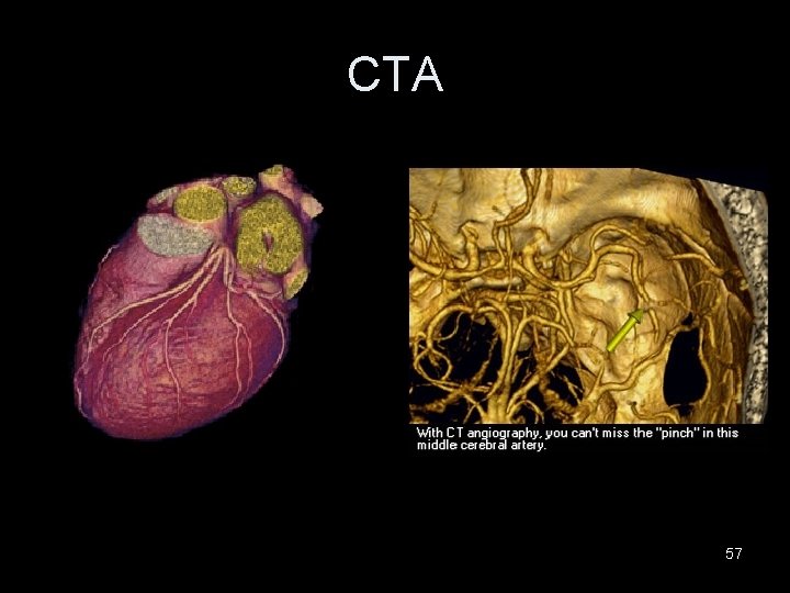 CTA 57 