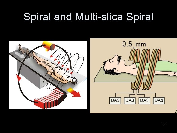 Spiral and Multi-slice Spiral 59 