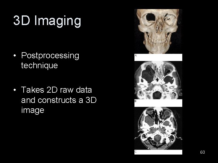 3 D Imaging • Postprocessing technique • Takes 2 D raw data and constructs