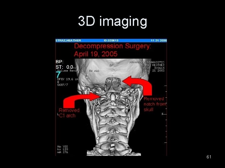 3 D imaging 61 