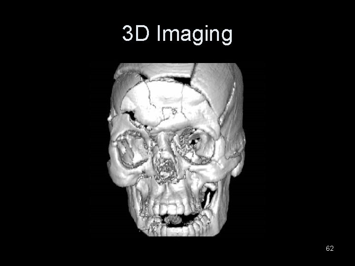 3 D Imaging 62 