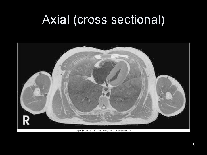 Axial (cross sectional) 7 