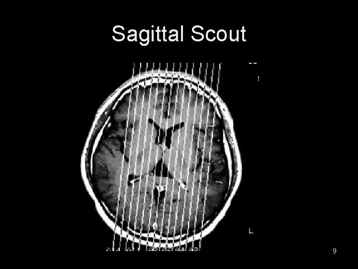 Sagittal Scout 9 