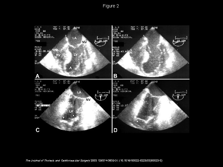 Figure 2 The Journal of Thoracic and Cardiovascular Surgery 2003 126374 -383 DOI: (10.