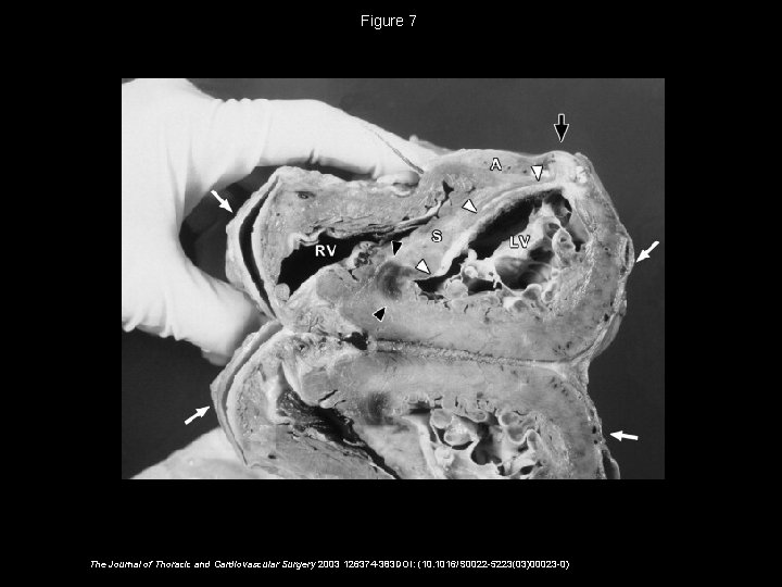 Figure 7 The Journal of Thoracic and Cardiovascular Surgery 2003 126374 -383 DOI: (10.