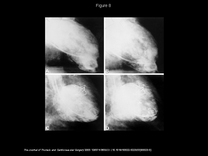 Figure 8 The Journal of Thoracic and Cardiovascular Surgery 2003 126374 -383 DOI: (10.