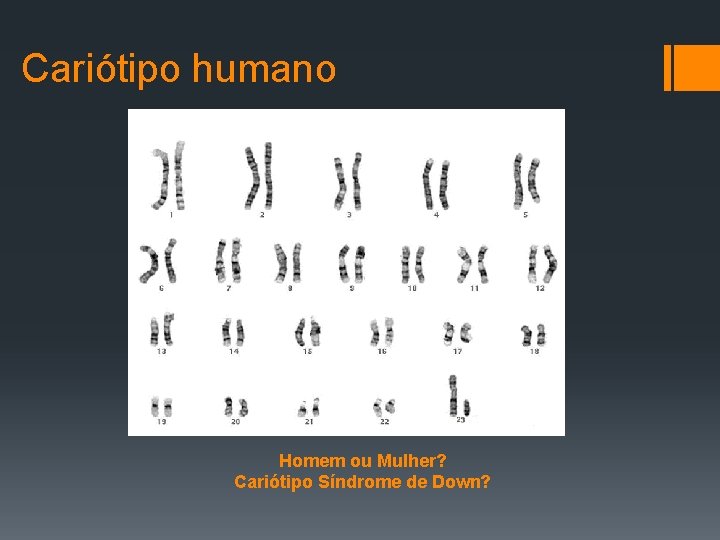 Cariótipo humano Homem ou Mulher? Cariótipo Síndrome de Down? 