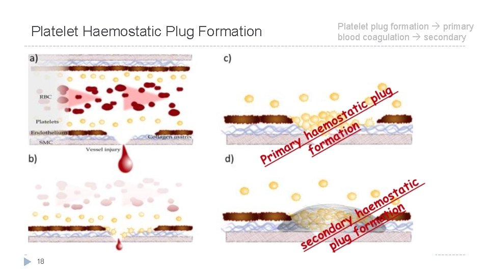 Platelet Haemostatic Plug Formation 18 Platelet plug formation primary blood coagulation secondary 