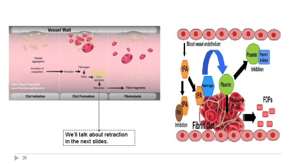 We’ll talk about retraction in the next slides. 26 