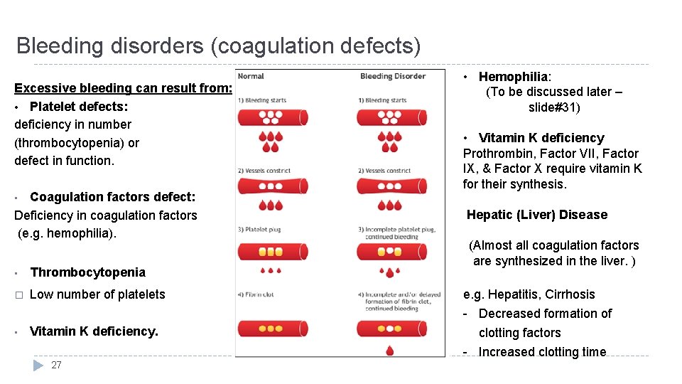 Bleeding disorders (coagulation defects) Excessive bleeding can result from: • Platelet defects: deficiency in