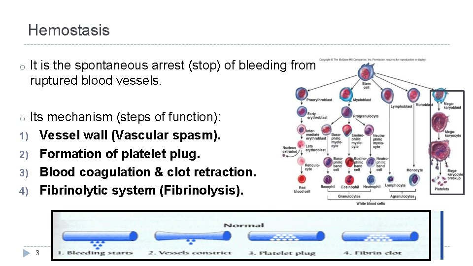 Hemostasis o It is the spontaneous arrest (stop) of bleeding from ruptured blood vessels.